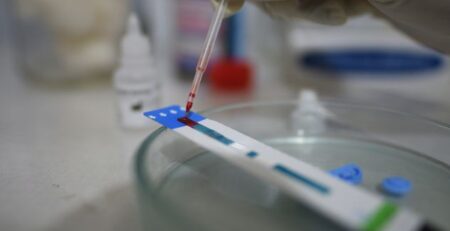 HIV testing. Tajikistan, 2021. Credit: UNAIDS